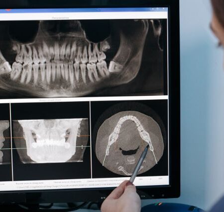 Curso de Odontología Restauradora Basados en Nuevas Tecnologías, Curso de Odontología Restauradora Basados en Nuevas Tecnologías, Odontología Restauradora, odontología, restauración de los dientes, desgaste dental, radiología digital, odontología, ISEIE, Institución Superior Estudios Innovadores Europeos, restauración dental, odontología restauradora, rehabilitación dental, profesionales de la odontología, Odontología Restauradora, Tejido Dental, Enfermedad Periodontal, Desgaste Dental, Forma de los Dientes, Rehabilitación Oral, Prótesis Dentales, Rehabilitación Oral Asistida por Ordenador, Radiología Digital, Restauraciones Dentales, Odontología Digital, Odontología Restauradora