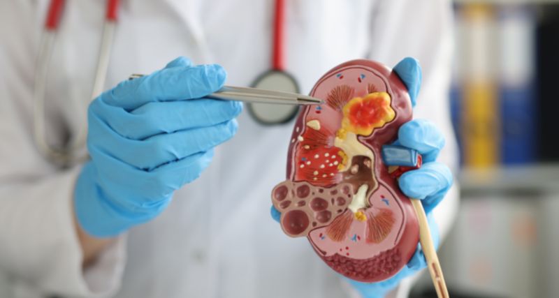 ISEIE-Máster en Avances en Cirugía Urológica general