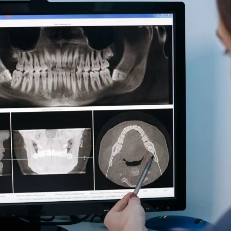 ISEIE, odontologia digital, odontología digital, curso odontologia digital, curso de odontologia digital, cursos odontologia digital, odontología digital cursos, odontologia, odontología, que es odontologia, odontología que es, odontología que es, odontologia carrera, odontologia carrera, odontologia carrera, facultad de odontologia, Máster Odontología Digital