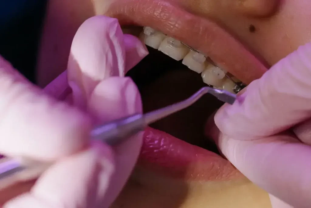 Diplomado en Odontología Digital 1