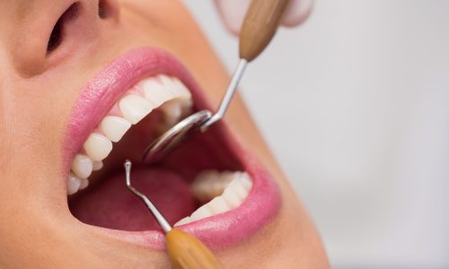 Diplomado-en-Odontologia-Estetica-2.jpg