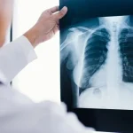 ISEIE-Master-en-Oncologia-Toracica