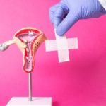 ISEIE-Master en estudios para Endometriosis, Maestría en Endometriosis