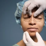 Maestria-en-Cirugia-Estetica-Facial-Rinoplastia-Blefaroplastia-y-Rejuv-2dec321b
