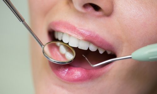 dentista-examinando-paciente-herramientas.jpg
