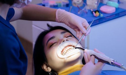 diplomado en odontología estética, rehabilitación oral,tratamiento estético, reposición de tejidos duros, odontólogo, morfología, salud bucodental, tratamientos de estética, odontología, iseie, odontólogos